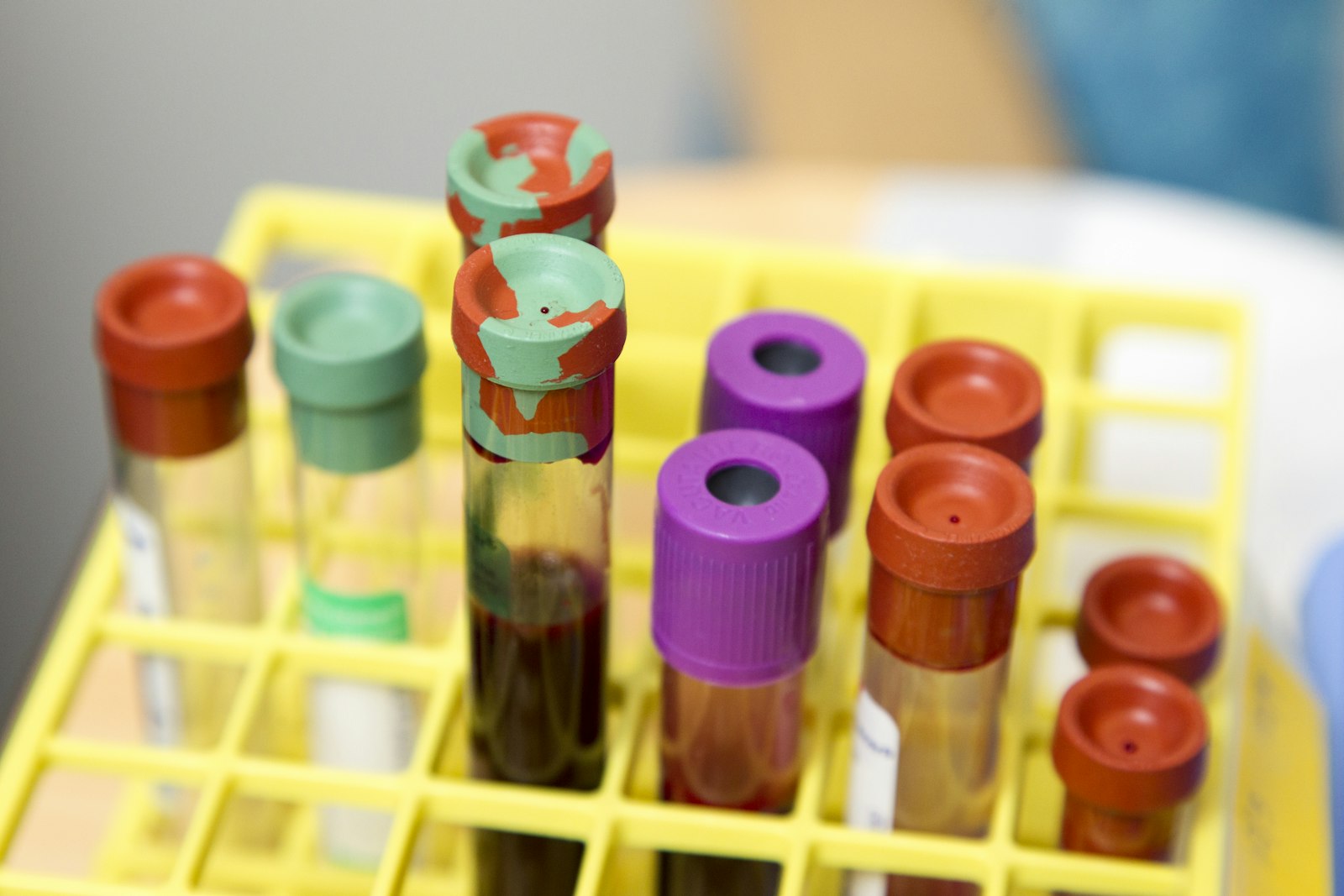Row of labelled blood-test sample vials in a laboratory rack